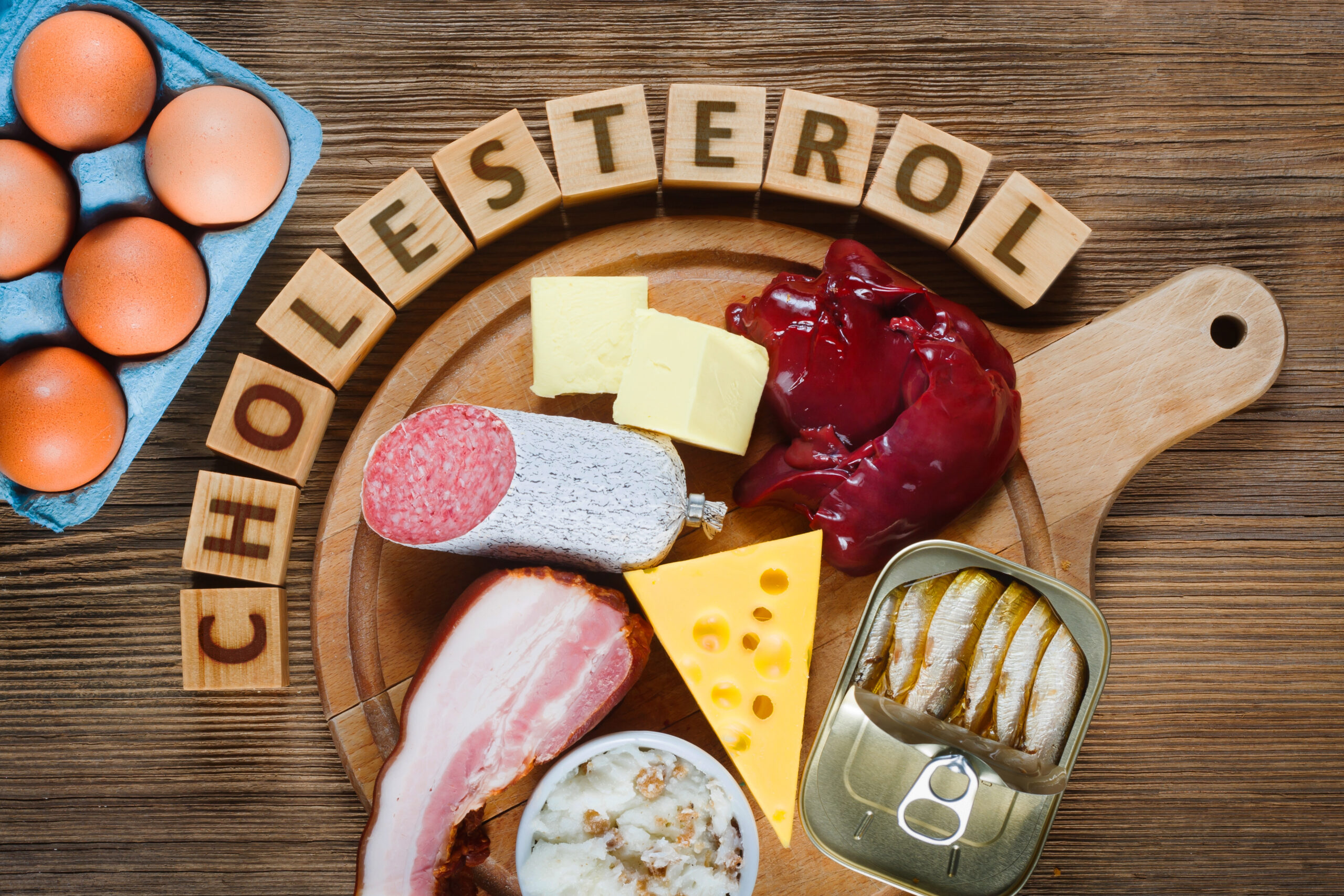 Kennst du den Unterschied zwischen gutem und schlechtem Cholesterin? Kennst du den Unterschied zwischen gutem und schlechtem Cholesterin?